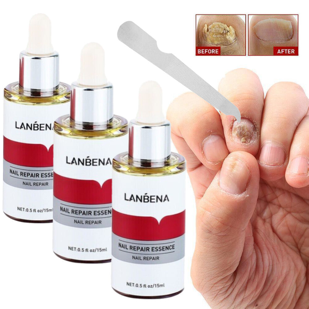 LANBENA Nail repair