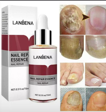LANBENA Nail repair
